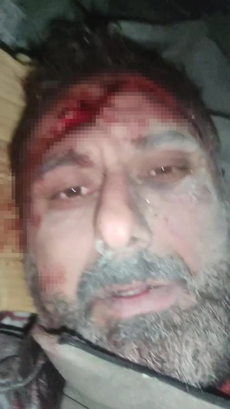 Enkaz altında yaşadığı diyalogla depremin acısını unutturan Ahmet ağabey, asrın felaketinin üzerinden yıllar geçse de söyledikleriyle gülümsetiyor