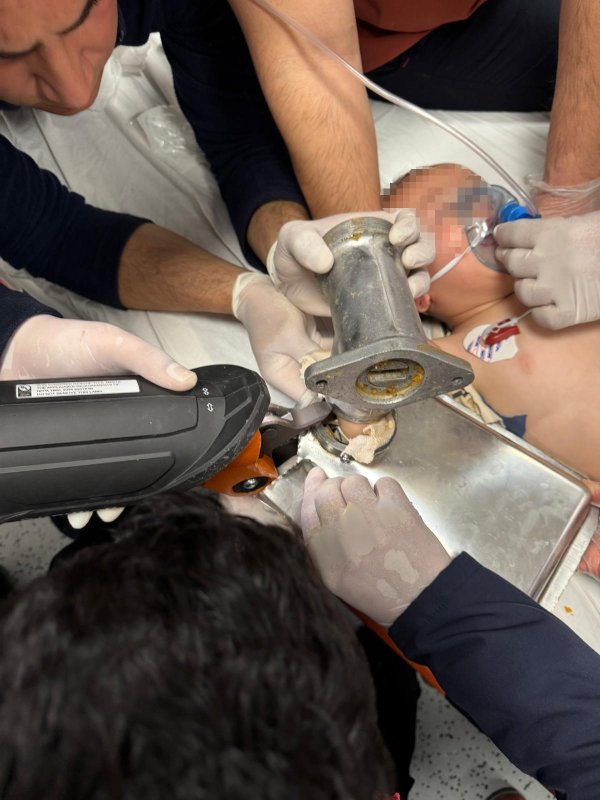 2 yaşındaki çocuk elini kıyma makinesine kaptırdı