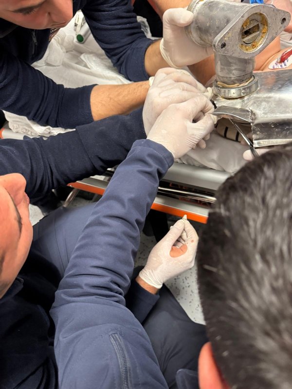 2 yaşındaki çocuk elini kıyma makinesine kaptırdı