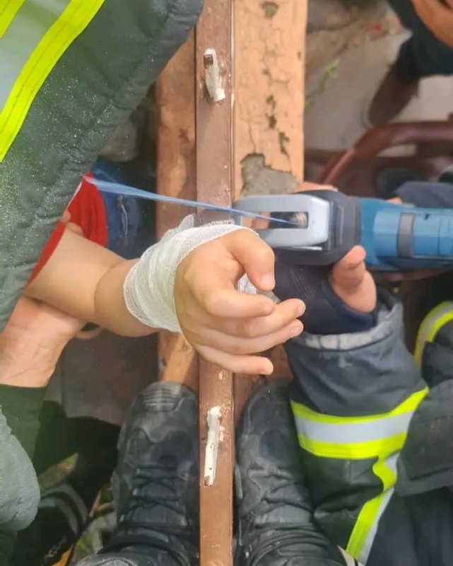 Çocuğun kolu demir korkuluğa saplandı