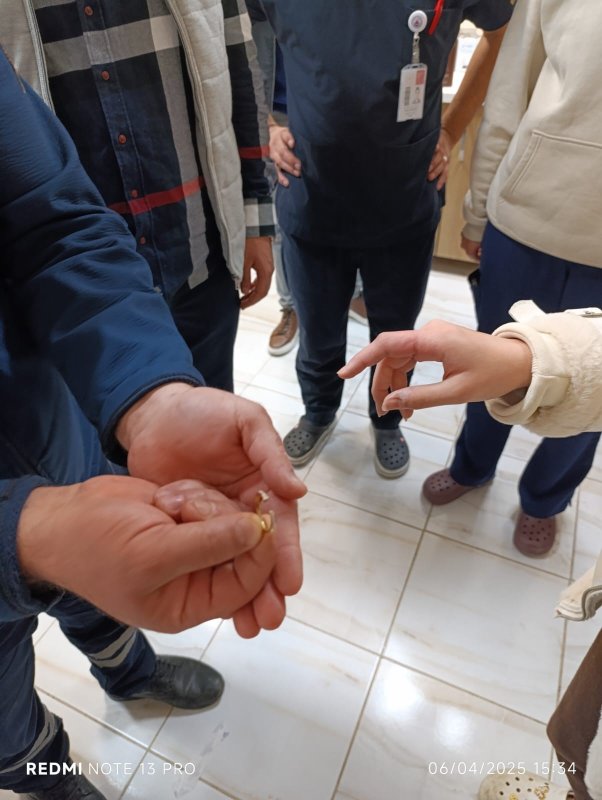  Parmağında yüzük sıkışan vatandaşın yardımına itfaiye koştu