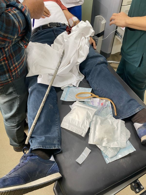 İnşaat işçisinin yüzüne demir saplandı