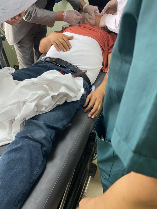 İnşaat işçisinin yüzüne demir saplandı