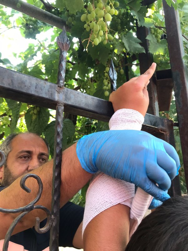 Korku dolu anlar, çocuğun eline demir saplandı