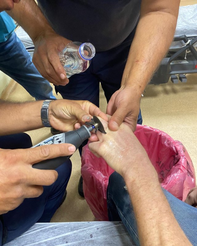 İtfaiyeden yüzük çıkarma operasyonu