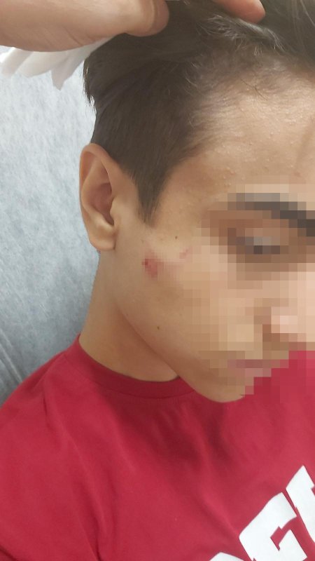Aynı okulda okuduğu akranı tarafından demir sopalı saldırıya uğrayan öğrenci yaralandı