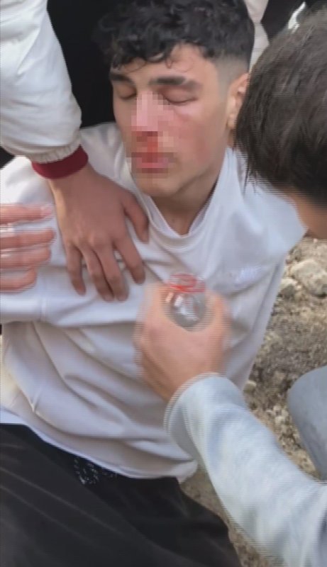 Maç sonu yaşanan kavgada 3 futbolcu yaralandı