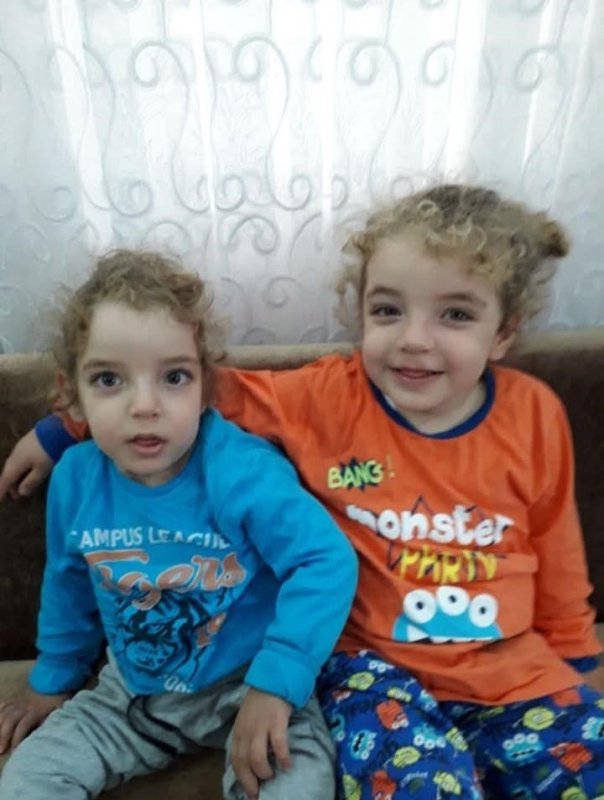 Siyam İkizlerinden Ali Haydar Hayatını Kaybetti