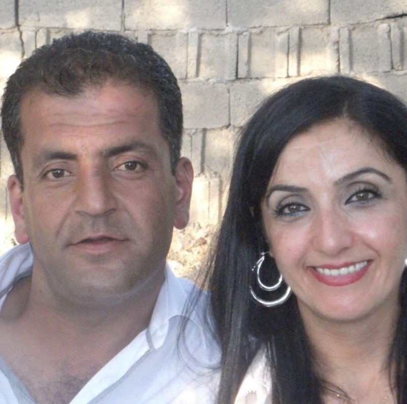 Siyam İkizlerinden Ali Haydar Hayatını Kaybetti