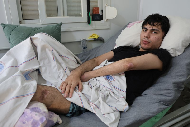 Depremden Kurtulan Genç, Fizik Tedavi Yardımı Bekliyor