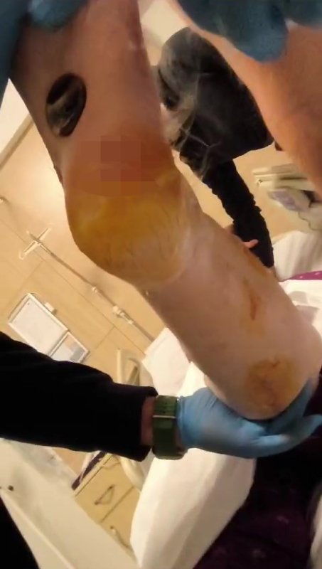 Depremde 2 kızını ve sol kolunu kaybeden annenin yeni yılda tek bir dileği var