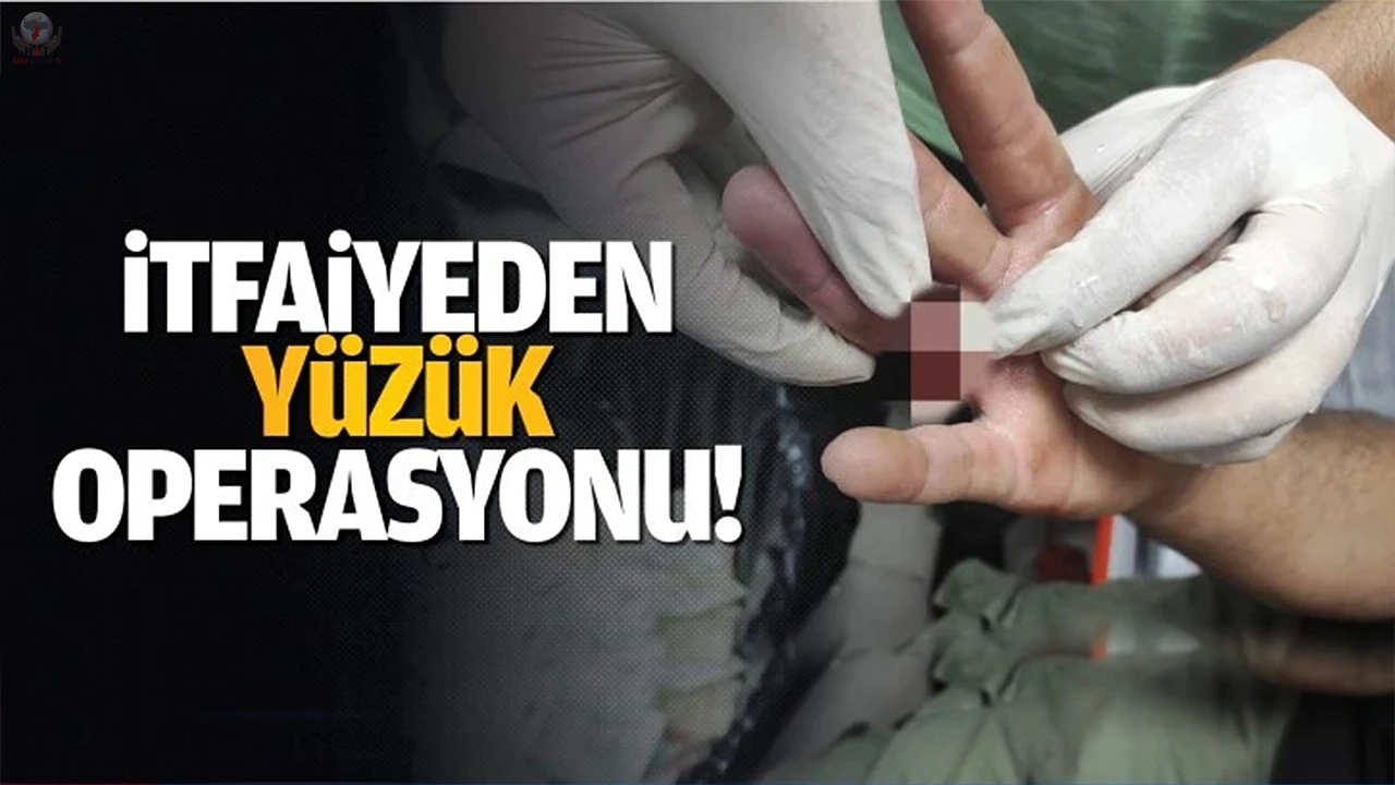 İtfaiyeden yüzük çıkarma operasyonu