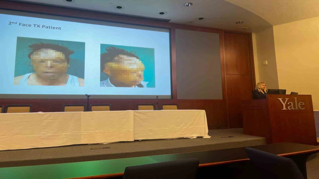 Rektör Özkan, Yalede Türkiyenin sağlık alanındaki başarısını anlattı