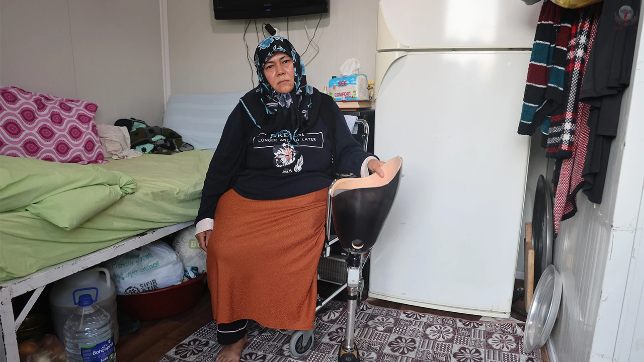 Protez bacağının değişimi için görüştüğü firmadan olumsuz cevap aldı