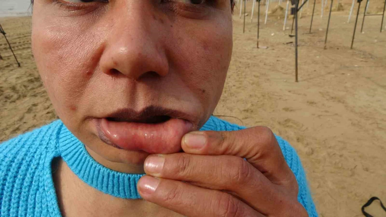 220 bin TLye estetik oldu, hayatı kabusa döndü