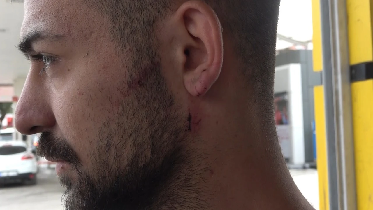 Kavgayı ayırmak isterken kulağından ısırıldı