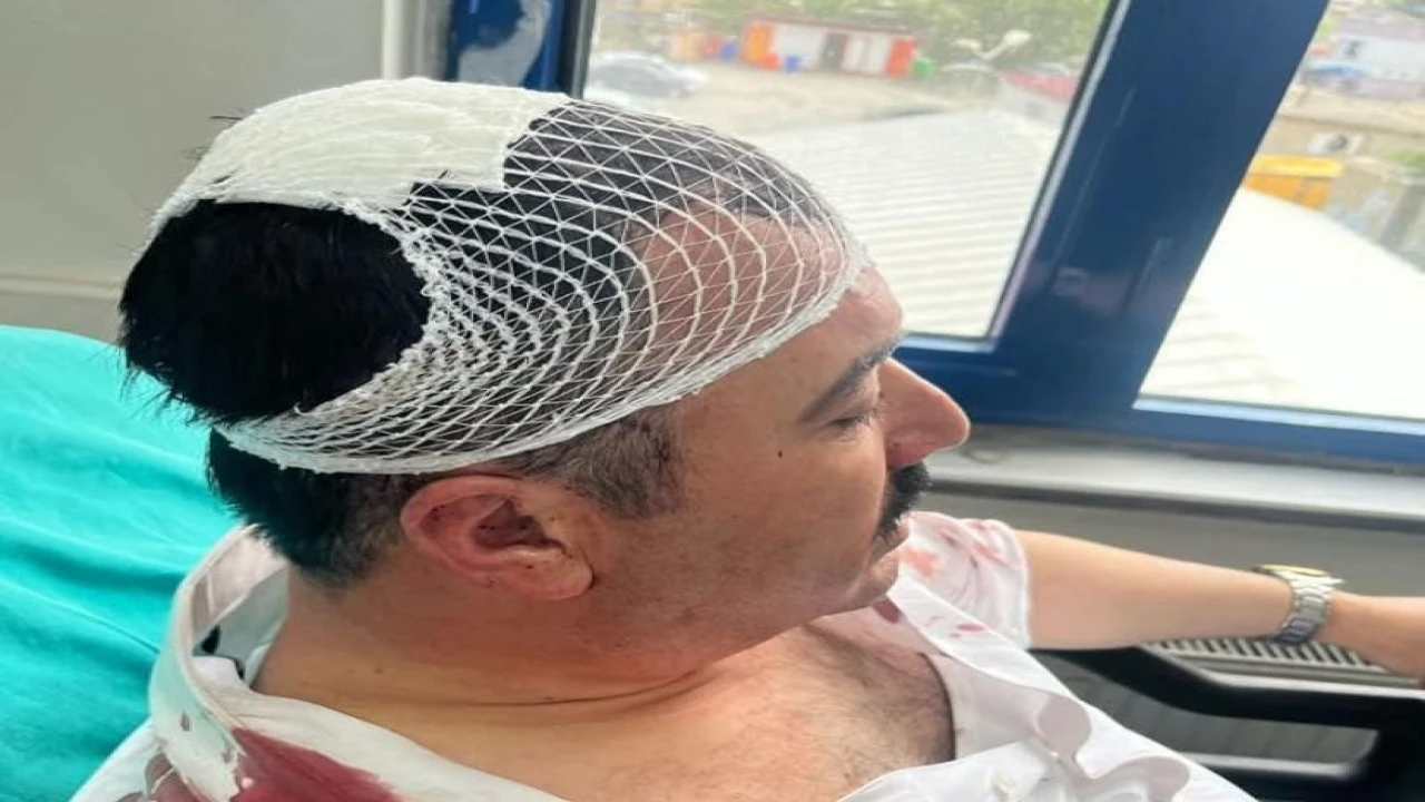 Belediye başkan yardımcısını şekerlikle yaralayan YRPli başkan yardımcısı tutuklandı