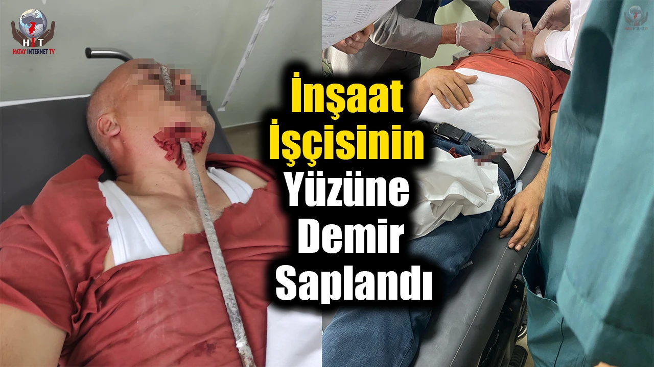 İnşaat işçisinin yüzüne demir saplandı