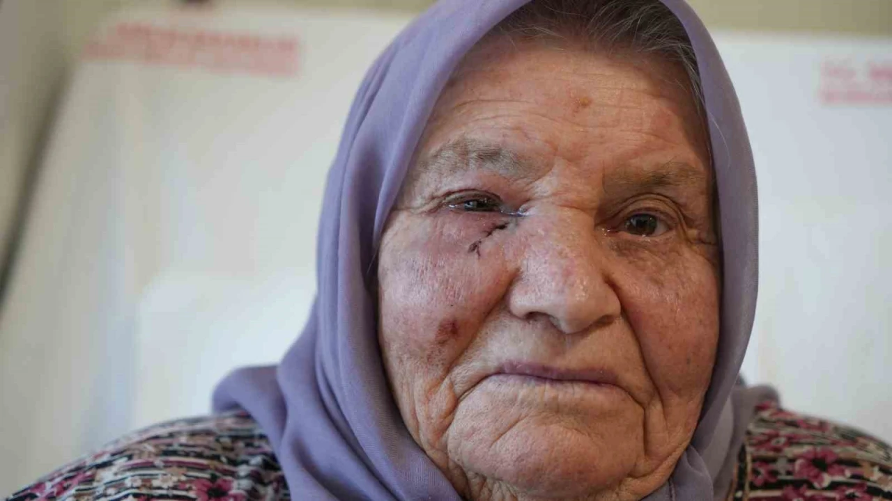 Dört mevsim gözyaşı yağmuru, bir cerrahiyle güneşle buluştu