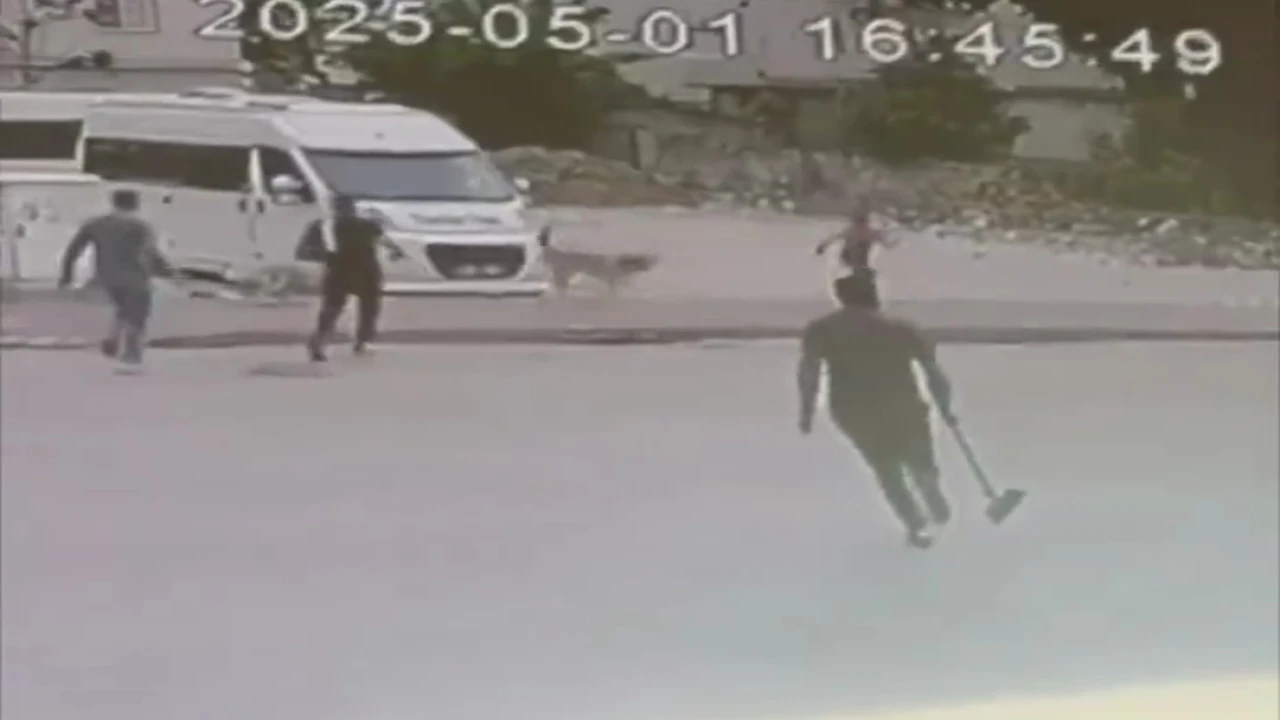 Sokak köpekleri çocuğa saldırdı