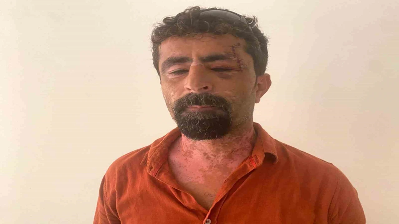 Antalyada öfkeli damat kayınpederini hastanelik etti