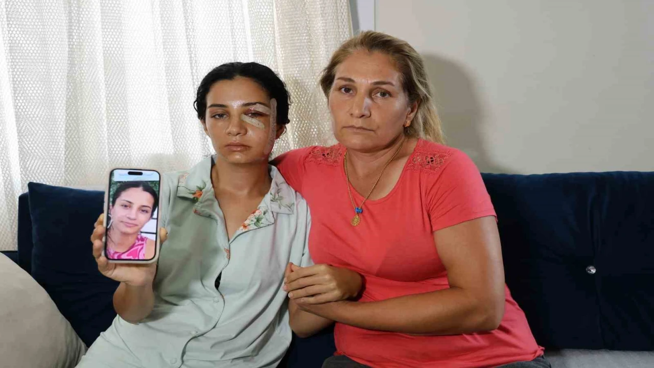 Eski eşinden şiddet gören kadın: Ben yaşarken kurtulayım, öldükten sonra değil