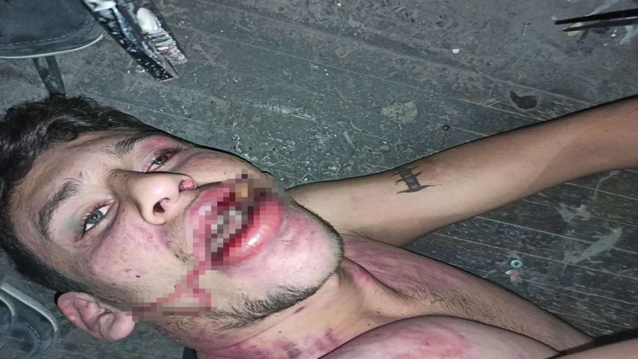 Antalyada Böcek yedirip dişlerimi kırdılar iddiasına 20 yıl hapis talebi