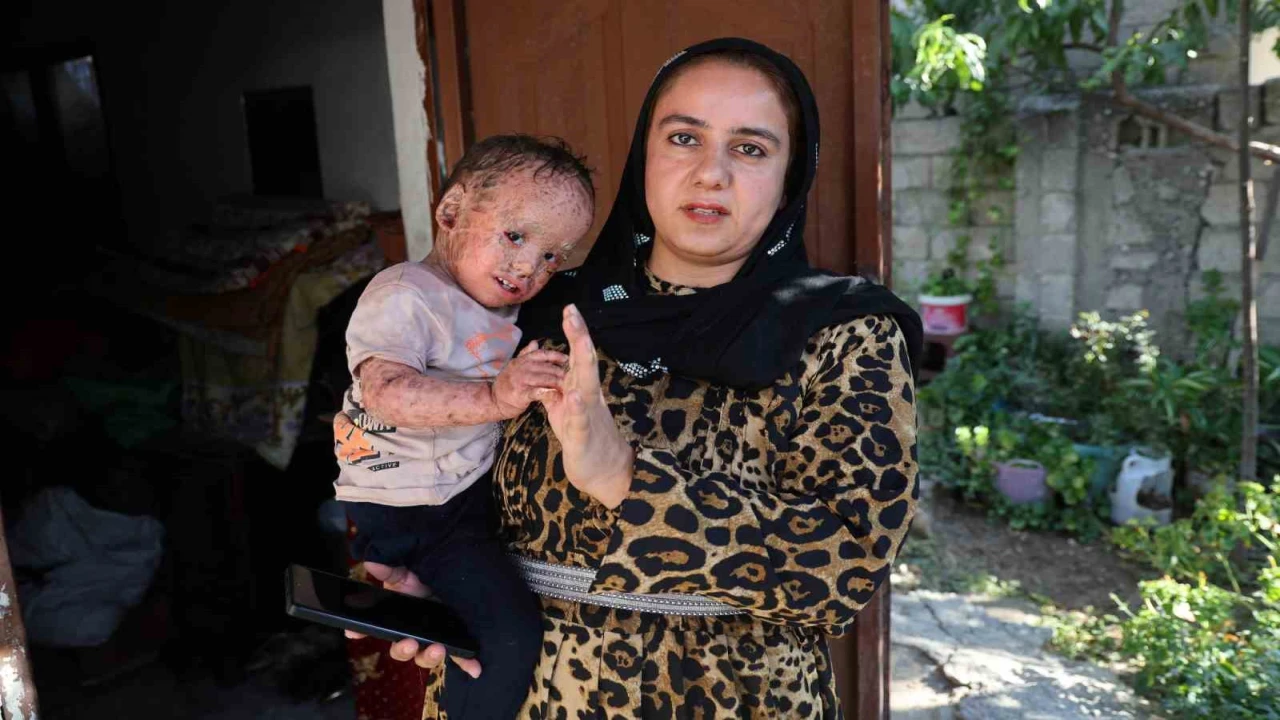 Balık pulu ve kelebek hastası Yusufun yardım paralarını dolandırıcılar topladı