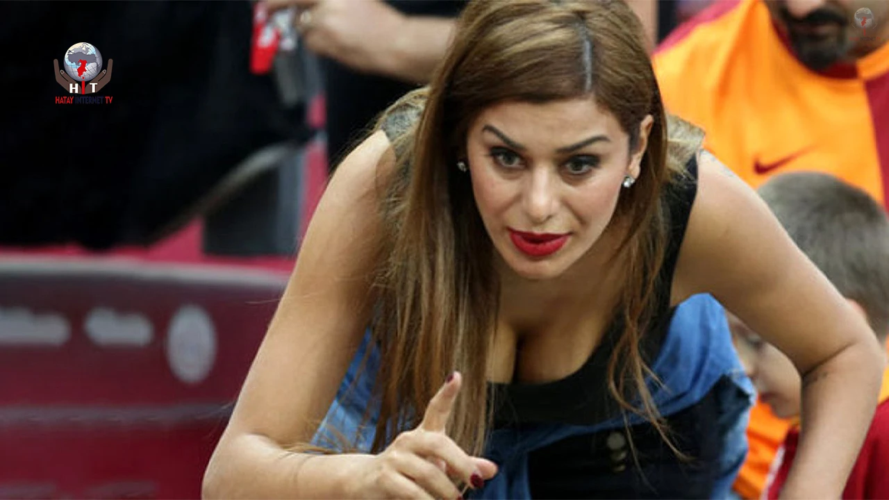 Botoksu fazla kaçtı!