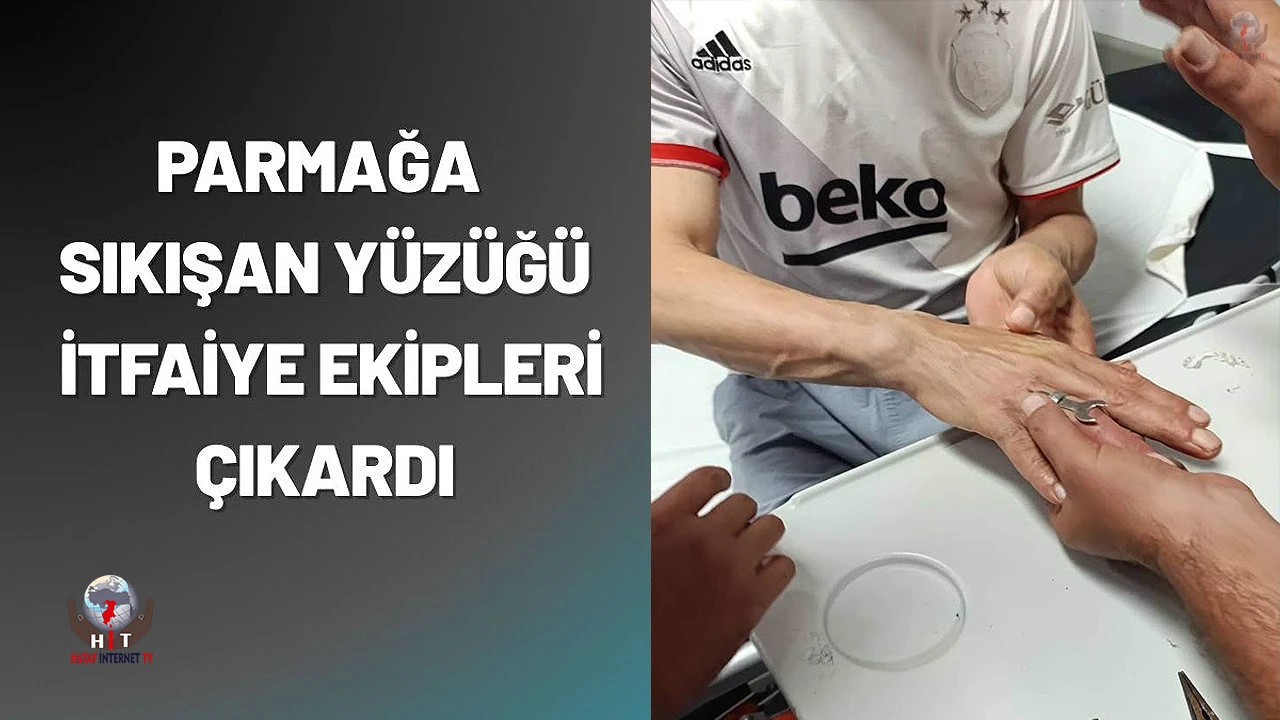 Antakyada vatandaşın parmağına sıkışan yüzüğü itfaiye çıkardı