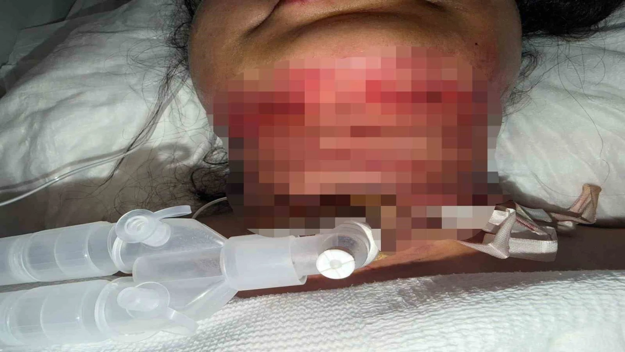 Gıdı estetiği sonrası nefes alamadı, boynundan acil solunum yolu açıldı
