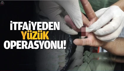 İtfaiyeden yüzük çıkarma operasyonu