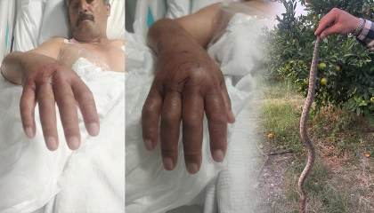 Hatayda çiftçiyi narenciye toplarken yılan soktu