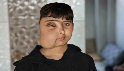 Enes gen tedavisiyle sağlığına kavuşacak