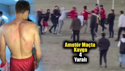 Hatay'da Amatör Maçta Kavga: 4 Yaralı
