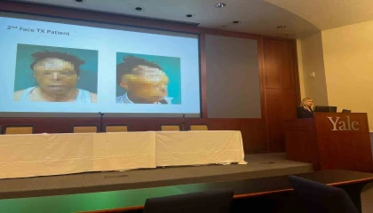 Rektör Özkan, Yalede Türkiyenin sağlık alanındaki başarısını anlattı