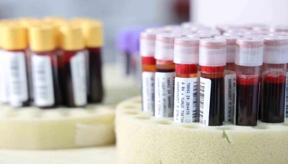 Kızılaya 2024te 2 milyon 800 bin ünite kan bağışlandı