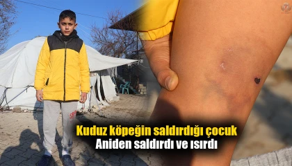 Kuduz köpeğin saldırdığı çocuk: Beni ısırmayacağını düşünmüştüm ama aniden saldırdı ve ısırdı