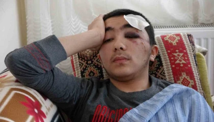 Başıboş köpeklerden kaçarken düşen 16 yaşındaki hafız ölümden döndü