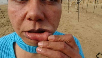 220 bin TLye estetik oldu, hayatı kabusa döndü