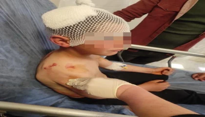 Ispartada sokakta oynayan çocuğa başıboş köpek saldırdı