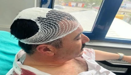 Belediye başkan yardımcısını şekerlikle yaralayan YRPli başkan yardımcısı tutuklandı