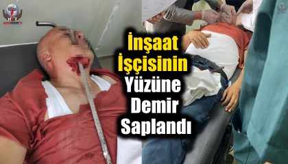 İnşaat işçisinin yüzüne demir saplandı
