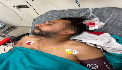 Adanada döner ustası çalışırken başından yorgun mermiyle yaralandı