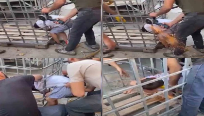 Kafesin parmaklıklarına sıkışan çocuk, demir kesilerek kurtarıldı