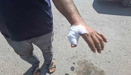 Kahramanmaraşta acemi kasaplar hastaneye koştu