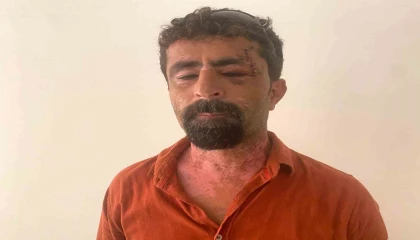 Antalyada öfkeli damat kayınpederini hastanelik etti