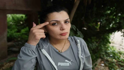 Cezaevinden firar etti, yüzünü bıçakladığı kadına Affına sığınıyorum mesajı attı