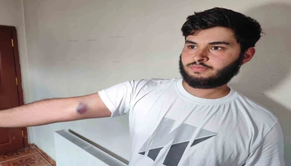 Conolar hem topu vermedi hem de aileye sopalı silahlı saldırıda bulundu