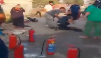 Kahramanmaraşta konteynerde yangın: 1 çocuk yaralandı